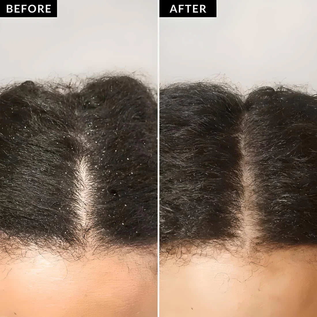 🔥Press On Dandruff Wash-Free Hair Comb